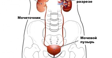 Цистит, пиелонефрит, уретрит