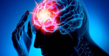 Пережить инсульт без последствий - возможно